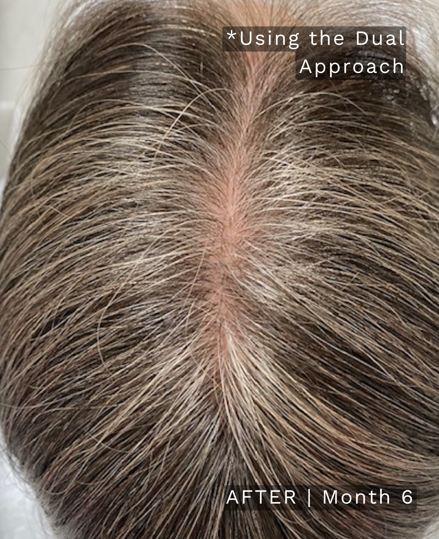 Before treatment