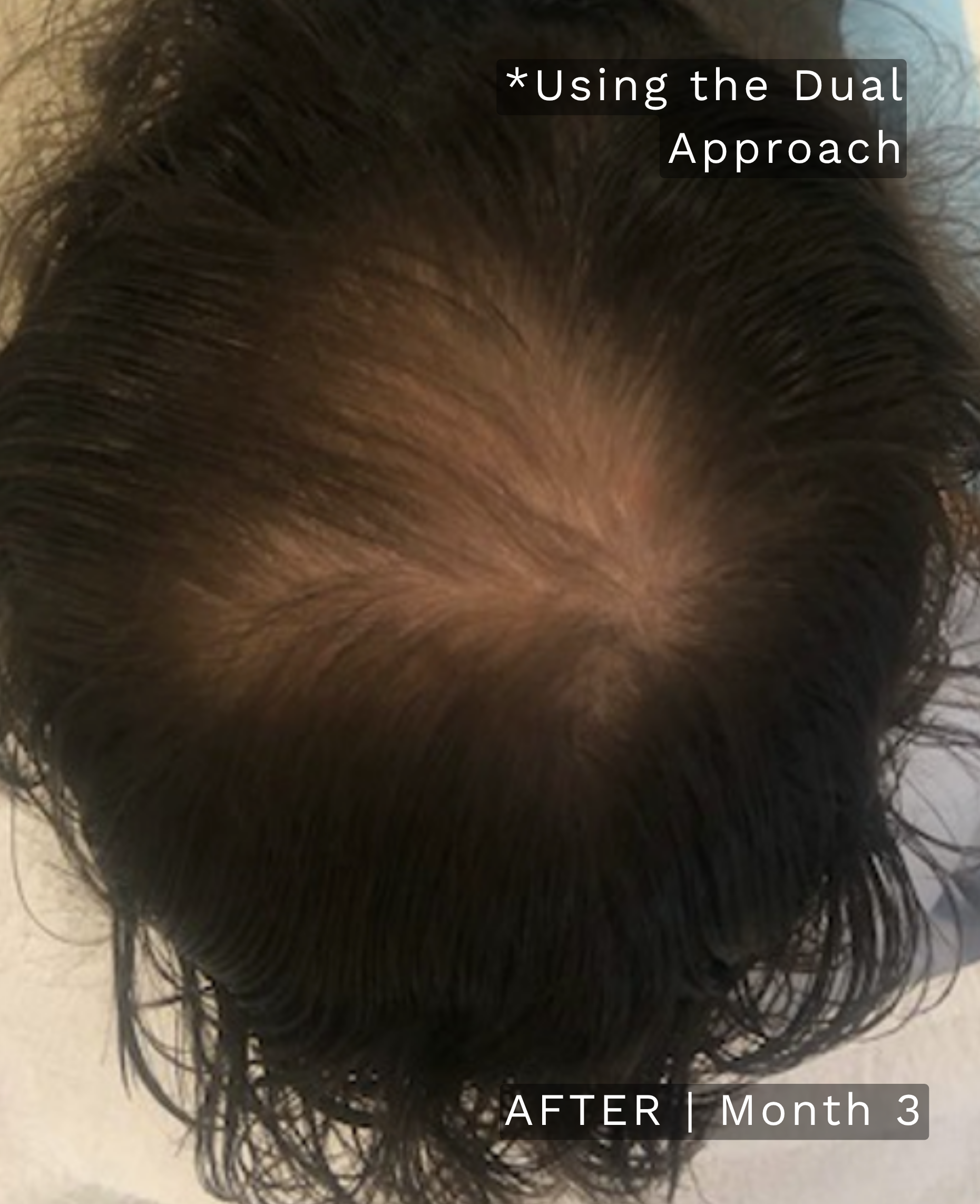 Before treatment