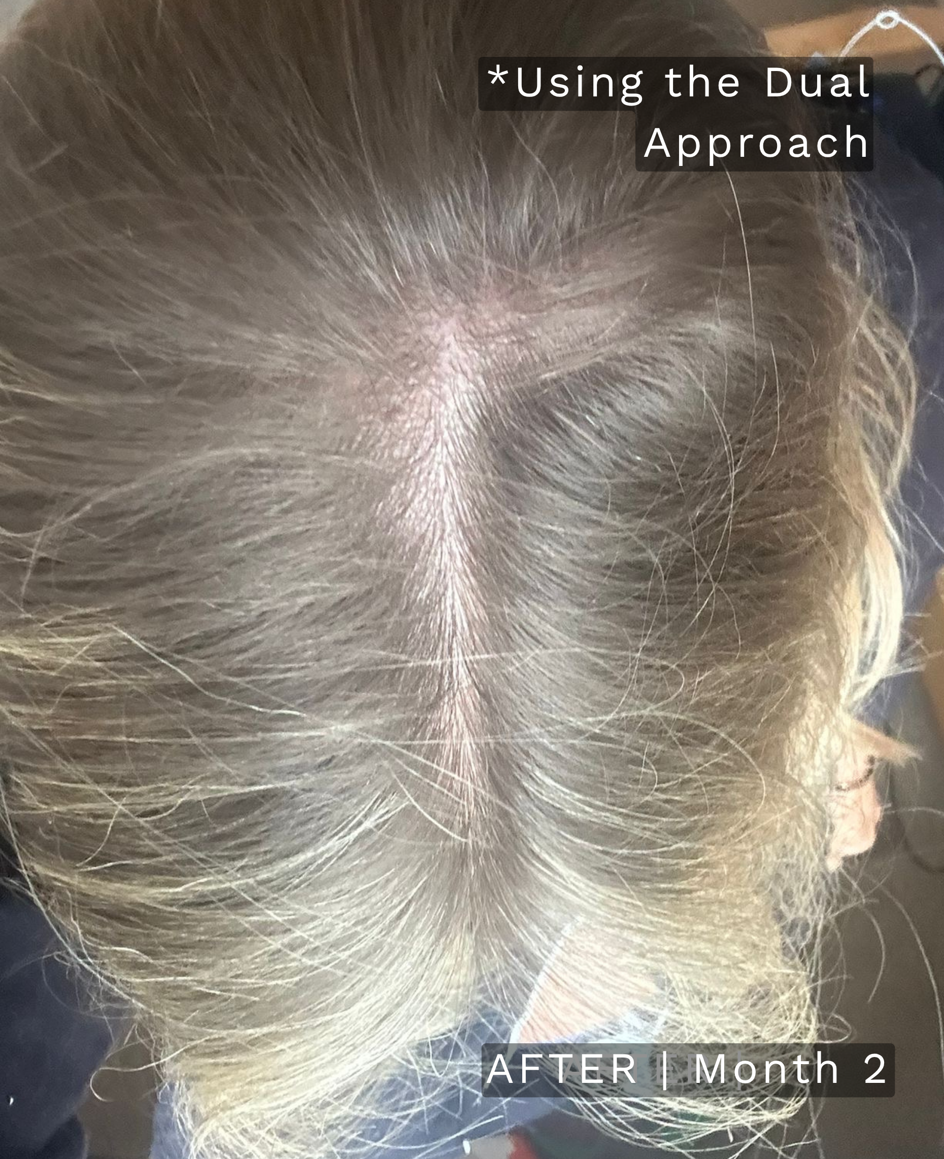 Before treatment