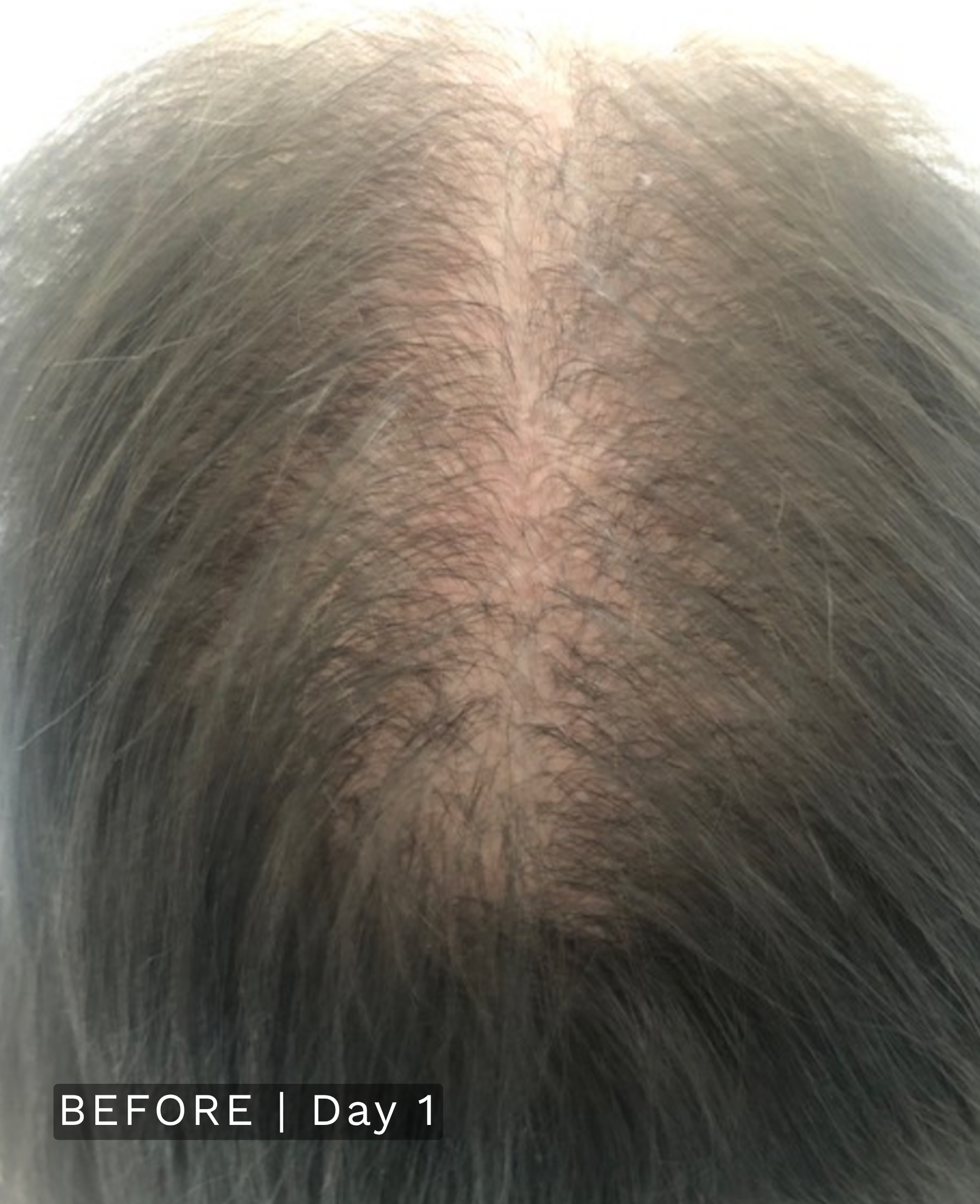 After treatment