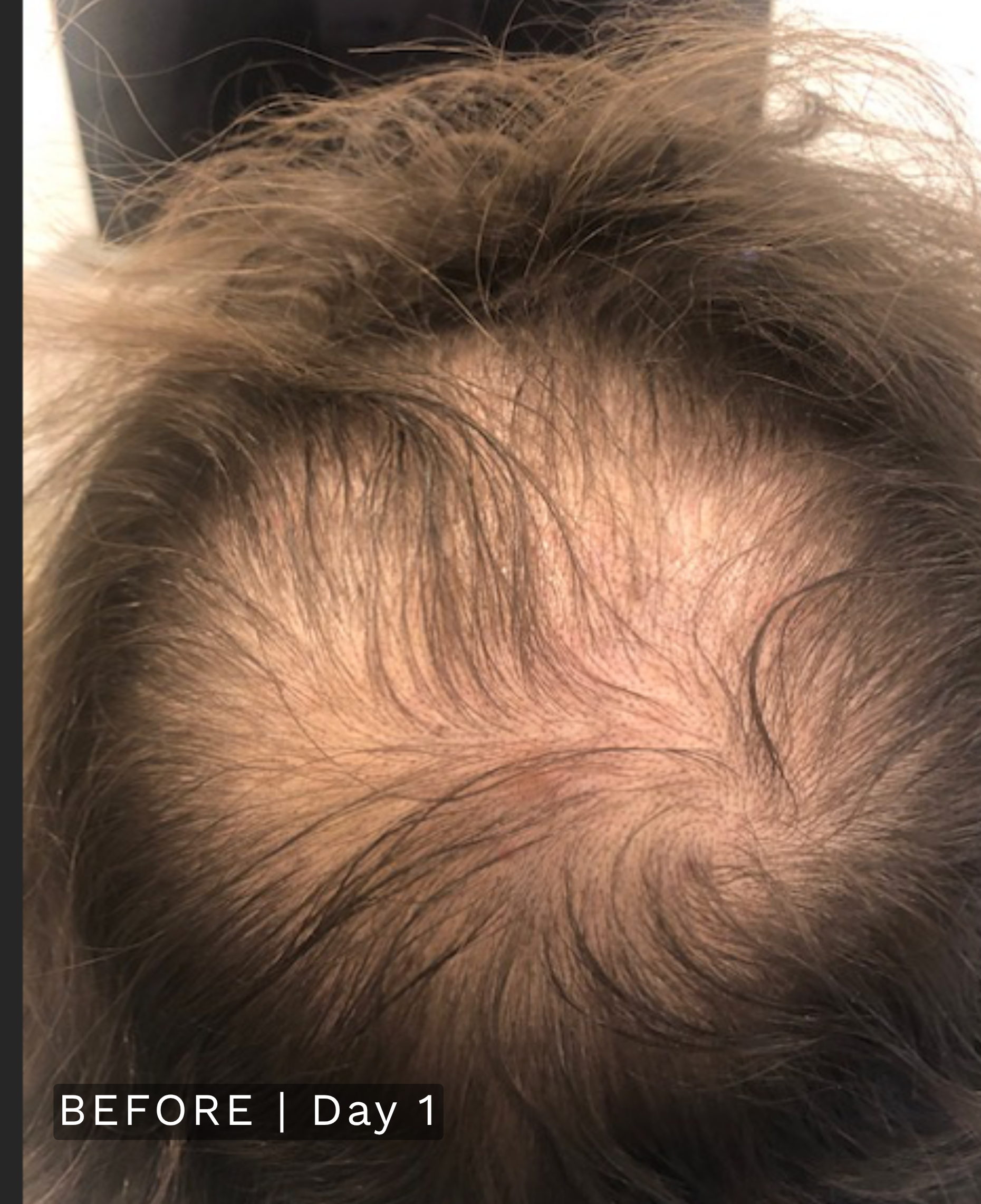 After treatment