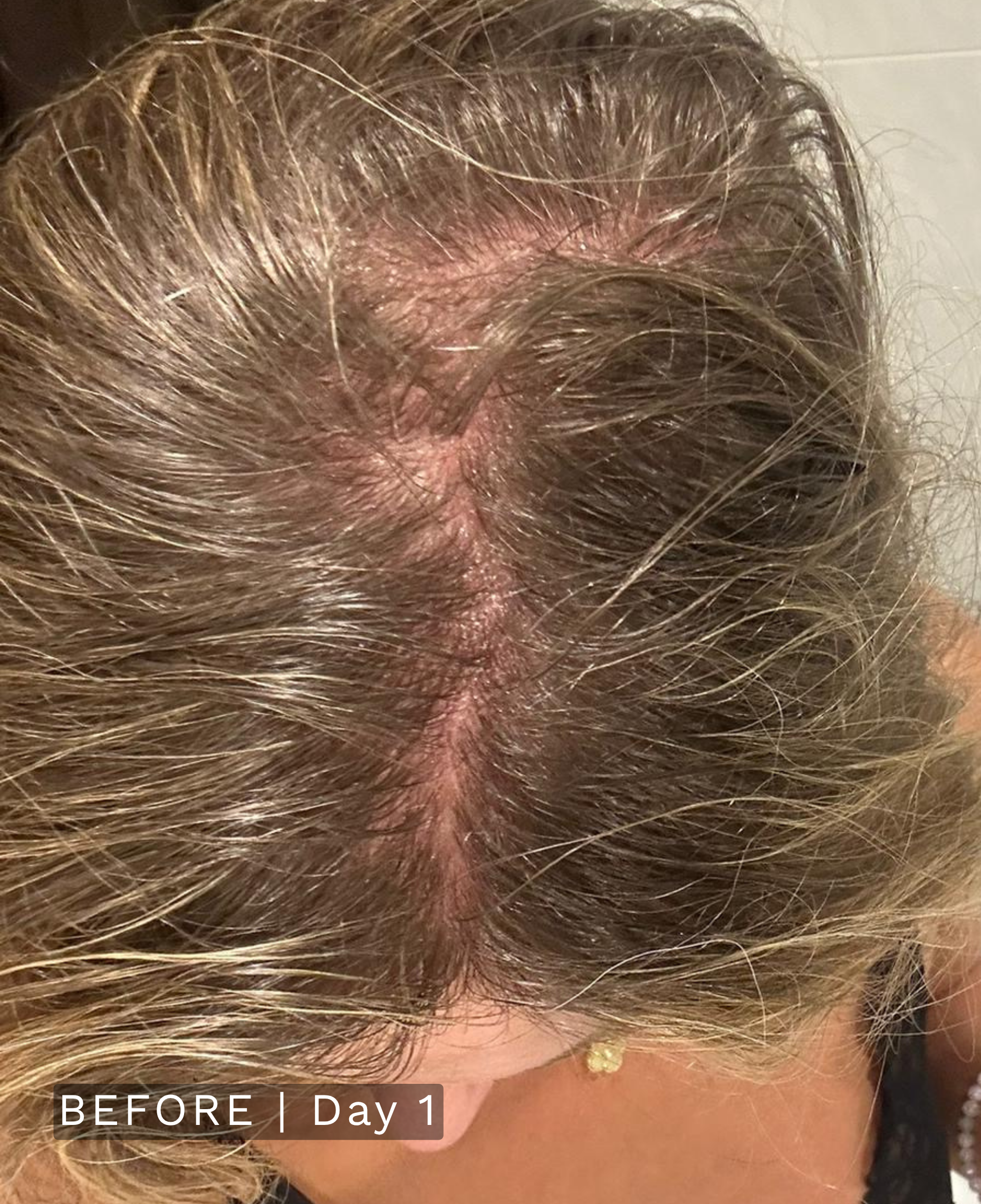 After treatment
