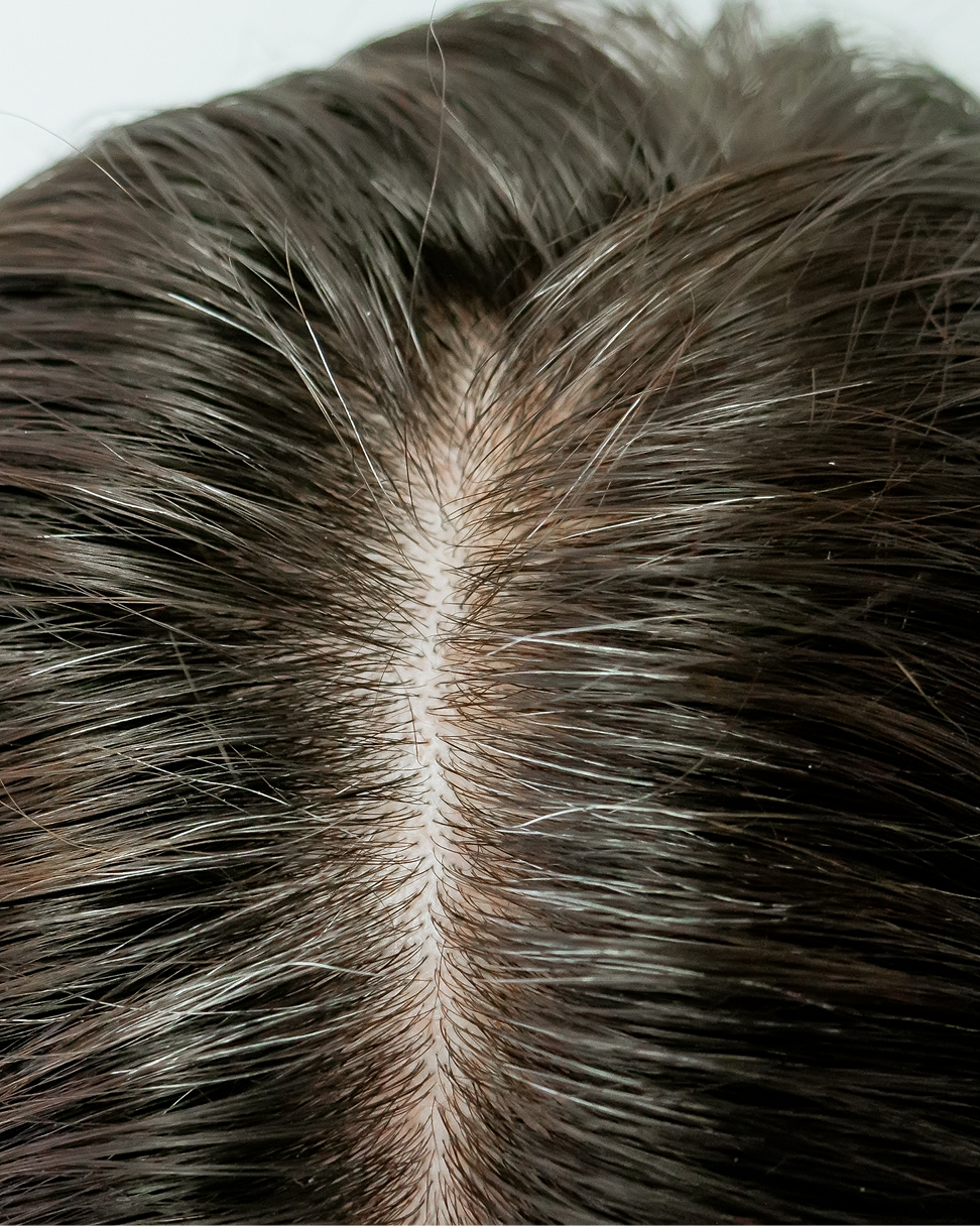 Hair Treatment